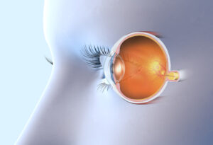 问医-林勤威-严重视网膜前膜 玻璃体切除术或剥膜术挽救视力问医